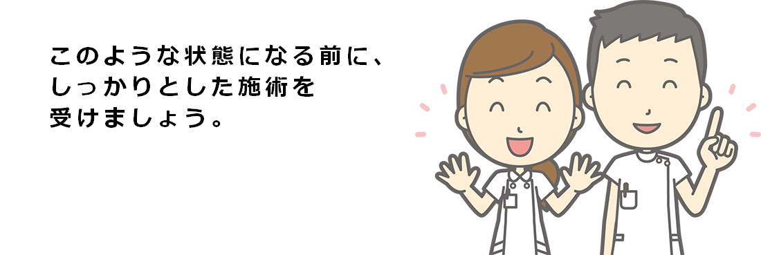 このような状態になる前に、しっかりとした施術を受けましょう。